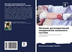 Buchcover von Лечение дегенеративной хондропатии коленного сустава