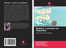 Buchcover von Abordar a oclusão em implantes