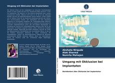 Umgang mit Okklusion bei Implantaten kitap kapağı