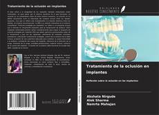 Bookcover of Tratamiento de la oclusión en implantes