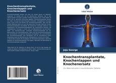 Knochentransplantate, Knochenlappen und Knochenersatz kitap kapağı