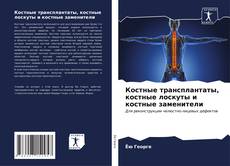 Portada del libro de Костные трансплантаты, костные лоскуты и костные заменители
