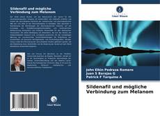 Bookcover of Sildenafil und mögliche Verbindung zum Melanom