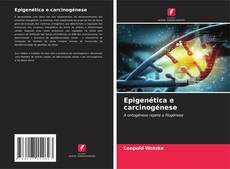 Buchcover von Epigenética e carcinogénese