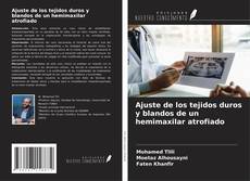 Portada del libro de Ajuste de los tejidos duros y blandos de un hemimaxilar atrofiado