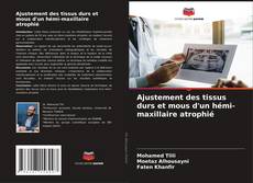 Borítókép a  Ajustement des tissus durs et mous d'un hémi-maxillaire atrophié - hoz