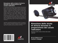 Buchcover von Rimozione dello strato di striscio durante la preparazione del canale radicolare