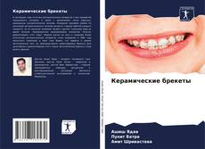 Capa do livro de Керамические брекеты 