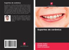 Bookcover of Suportes de cerâmica