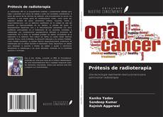 Capa do livro de Prótesis de radioterapia 