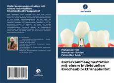 Couverture de Kieferkammaugmentation mit einem individuellen Knochenblocktransplantat