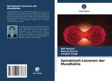 Bookcover of Spindelzell-Läsionen der Mundhöhle