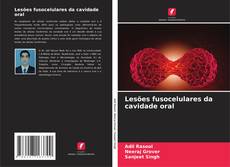 Buchcover von Lesões fusocelulares da cavidade oral