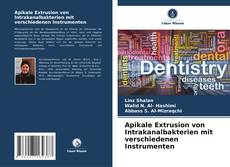 Bookcover of Apikale Extrusion von Intrakanalbakterien mit verschiedenen Instrumenten