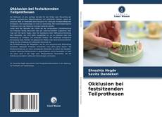 Portada del libro de Okklusion bei festsitzenden Teilprothesen