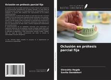 Oclusión en prótesis parcial fija kitap kapağı