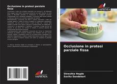 Occlusione in protesi parziale fissa kitap kapağı
