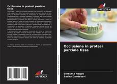 Copertina di Occlusione in protesi parziale fissa