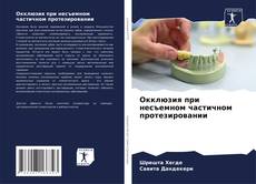 Окклюзия при несъемном частичном протезировании kitap kapağı