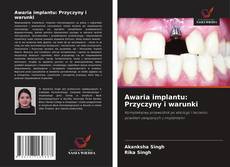 Copertina di Awaria implantu: Przyczyny i warunki