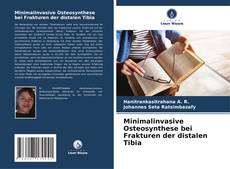 Portada del libro de Minimalinvasive Osteosynthese bei Frakturen der distalen Tibia