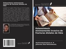 Bookcover of Osteosíntesis mínimamente invasiva de fracturas distales de tibia