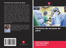 Bookcover of Factores de excesso de peso
