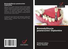Bookcover of Biomodyfikacja powierzchni implantów