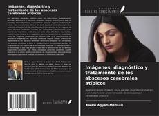 Bookcover of Imágenes, diagnóstico y tratamiento de los abscesos cerebrales atípicos
