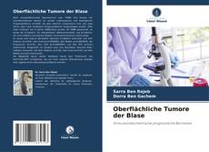 Portada del libro de Oberflächliche Tumore der Blase