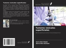 Bookcover of Tumores vesicales superficiales