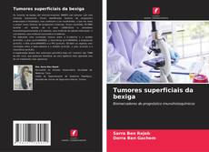 Bookcover of Tumores superficiais da bexiga