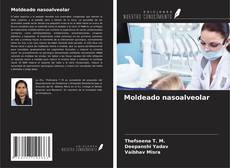 Bookcover of Moldeado nasoalveolar