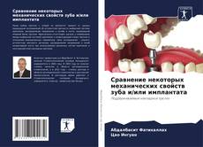 Bookcover of Сравнение некоторых механических свойств зуба и/или имплантата