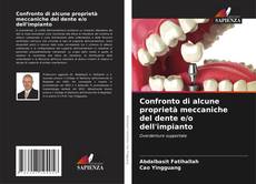 Copertina di Confronto di alcune proprietà meccaniche del dente e/o dell'impianto