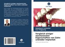 Borítókép a  Vergleich einiger mechanischer Eigenschaften von Zahn und/oder Implantat - hoz