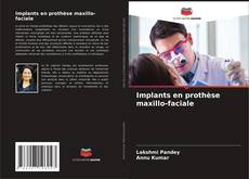 Buchcover von Implants en prothèse maxillo-faciale