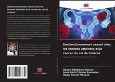 Dysfonctionnement sexuel chez les femmes atteintes d'un cancer du col de l'utérus的封面