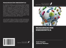 Bookcover of REAGUDIZACIÓN ENDODÓNTICA