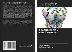 Portada del libro de REAGUDIZACIÓN ENDODÓNTICA