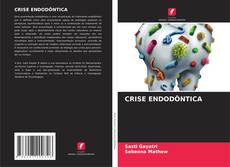 Buchcover von CRISE ENDODÔNTICA