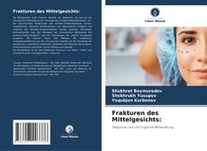 Capa do livro de Frakturen des Mittelgesichts: 