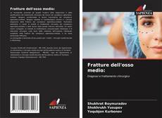 Capa do livro de Fratture dell'osso medio: 