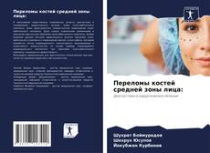 Portada del libro de Переломы костей средней зоны лица: