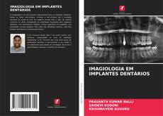 Capa do livro de IMAGIOLOGIA EM IMPLANTES DENTÁRIOS 