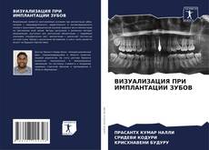 Couverture de ВИЗУАЛИЗАЦИЯ ПРИ ИМПЛАНТАЦИИ ЗУБОВ