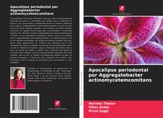 Buchcover von Apocalipse periodontal por Aggregatebacter actinomycetemcomitans