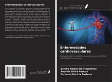Enfermedades cardiovasculares的封面