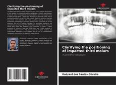 Couverture de Clarifying the positioning of impacted third molars