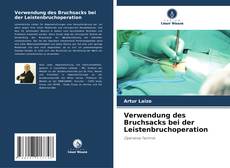 Verwendung des Bruchsacks bei der Leistenbruchoperation的封面